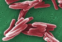 Tuberculosis researchers have identified a protein that plays an essential role in host defense against this deadly disease