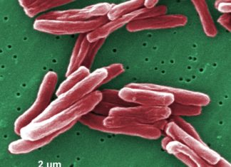 Tuberculosis researchers have identified a protein that plays an essential role in host defense against this deadly disease