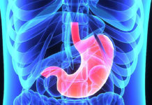 African Americans and Hispanic Americans who have undergone Roux-en-Y gastric bypass (RYGB) are at greater risk to regain weight as compared to Caucasians
