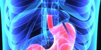 African Americans and Hispanic Americans who have undergone Roux-en-Y gastric bypass (RYGB) are at greater risk to regain weight as compared to Caucasians
