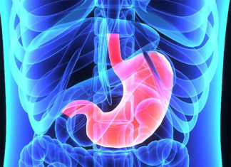 African Americans and Hispanic Americans who have undergone Roux-en-Y gastric bypass (RYGB) are at greater risk to regain weight as compared to Caucasians