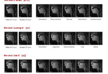 A new study uses real time MRI data to observe the vocal tracts of beatboxers before they produce a sound to see if the movements are different from speech