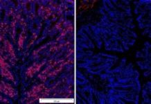 Binary therapeutic potential of BH4 – controls T cell proliferation in autoimmunity and cancer