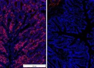Binary therapeutic potential of BH4 – controls T cell proliferation in autoimmunity and cancer