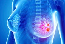 FDA approved drugs can help fight back triple-negative breast cancer