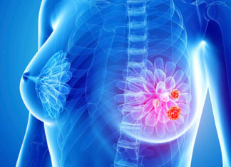 FDA approved drugs can help fight back triple-negative breast cancer