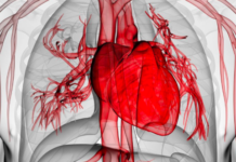 More personalized risk assessments for people at the highest risk for cardiovascular disease (CVD)
