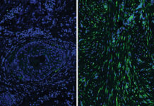 Differences in the cells that give skin its resilience and strength during wound repair may explain why individuals heal differently