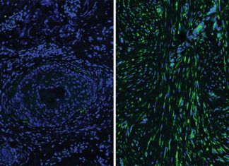 Differences in the cells that give skin its resilience and strength during wound repair may explain why individuals heal differently