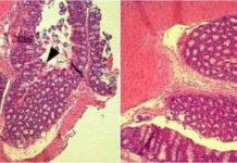 The treatment of intestinal infections caused by some strains of the bacterium Escherichia coli may have a new ally