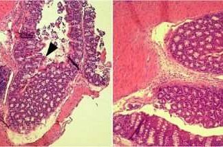 The treatment of intestinal infections caused by some strains of the bacterium Escherichia coli may have a new ally