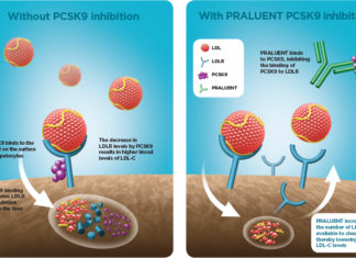Threatened heart attack : Researchers have found that drug alirocumab reduced the chance of having additional heart problems or stroke