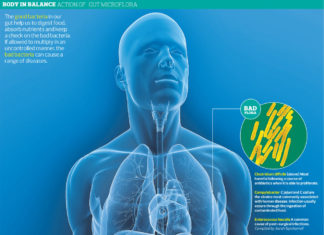 Transplanting gut bacteria from healthy donors was used to successfully treat patients suffering from severe colitis caused by treatment with immune checkpoint inhibitors (ICIs)