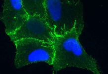 Researchers discovered how Hantaviruses infect lung cells