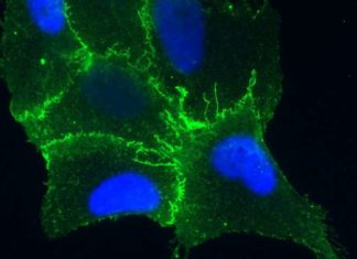 Researchers discovered how Hantaviruses infect lung cells