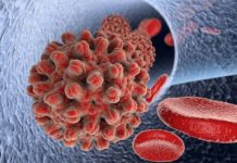 Not all chronic hepatitis B (HBV) patients require lifelong treatment