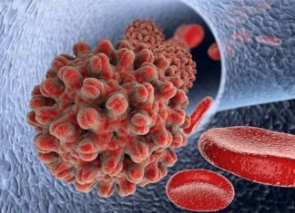 Not all chronic hepatitis B (HBV) patients require lifelong treatment