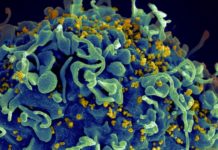 Researchers identified two patients with rare natural ability to suppress HIV shed light on potential functional cure