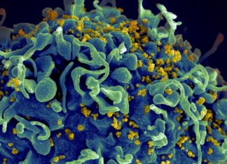 Researchers identified two patients with rare natural ability to suppress HIV shed light on potential functional cure