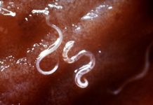 New research for development of hookworm vaccines – bacteria eating worms