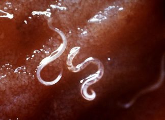 New research for development of hookworm vaccines – bacteria eating worms