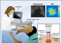 Researchers found an innovative way to use sound and light, or photoacoustic, imaging to diagnose ovarian tumors