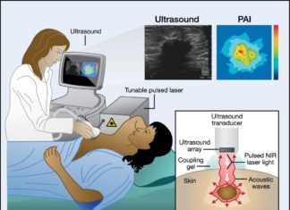 Researchers found an innovative way to use sound and light, or photoacoustic, imaging to diagnose ovarian tumors