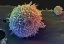 A new discovery could have implications for therapies for cancer and autoimmune diseases
