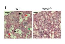Researchers discovered a pathway for enhancing the self-repair efforts of injured kidneys