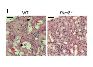 Researchers discovered a pathway for enhancing the self-repair efforts of injured kidneys