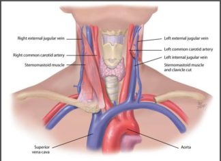 Researchers say a quick scan of blood vessels in the neck during mid life may help to predict those at risk of dementia up to ten years before symptoms appear