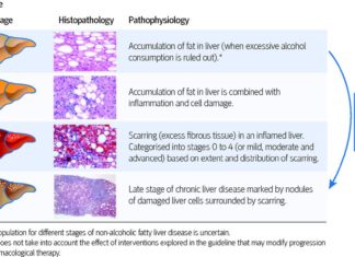 Researchers have made a discovery about how disease pathogenesis in the liver is regulated – nonalcoholic fatty liver disease (NAFLD)