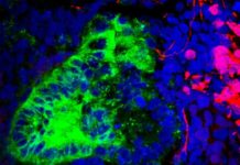 Organoids may help repair damaged kidneys in people or be used to test drugs developed to fight kidney disease