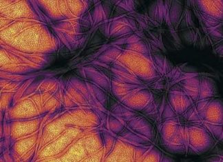 Researchers have found evidence of sCJD related prions in the eyes of patients