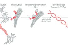 Alzheimer’s disease : Researchers discovered a mechanism by which harmful tau protein aggregates are transmitted between neurons