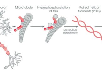 Alzheimer’s disease : Researchers discovered a mechanism by which harmful tau protein aggregates are transmitted between neurons