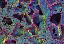 An approach to attract and capture elusive immune disease cells in vivo