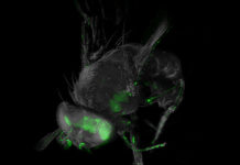 Ultramicroscope – it is now possible to image large nerve tissue samples and take high-resolution pictures of complex neural networks that have been labeled with fluorescent molecules