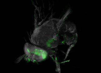 Ultramicroscope – it is now possible to image large nerve tissue samples and take high-resolution pictures of complex neural networks that have been labeled with fluorescent molecules