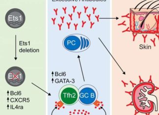 A research team has discovered the role of a key gene involved in the autoimmune disease systemic lupus erythematosus (SLE)