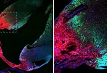Adult hearts contain no stem cells