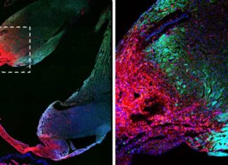 Adult hearts contain no stem cells