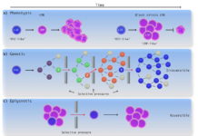 Advances in rapid screening of leukemia cells for drug susceptibility and resistance are bringing scientists closer to patient-tailored treatment for acute myeloid leukemia (AML)