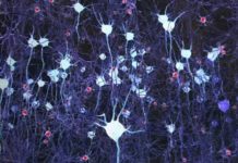 Alzheimer’s disease : Study links slowed brainwaves to early signs of dementia