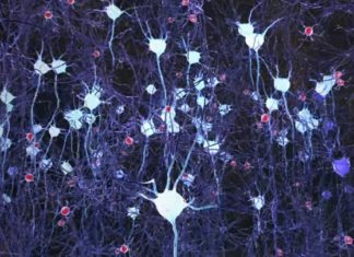 Alzheimer’s disease : Study links slowed brainwaves to early signs of dementia