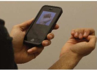 Biomedical engineers have developed a smartphone app for the non-invasive detection of anemia