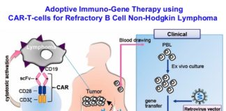 Phase-2 trial of a CAR-T cell therapy : Therapy improves outcomes for patients with B-cell lymphoma
