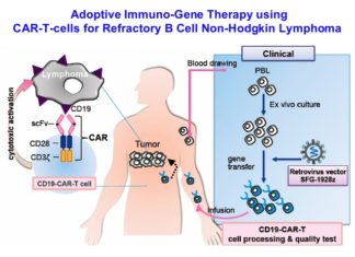 Phase-2 trial of a CAR-T cell therapy : Therapy improves outcomes for patients with B-cell lymphoma