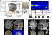 Emerging technique uses ultrasonic waves to noninvasively modulate brain activity