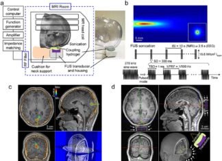 Emerging technique uses ultrasonic waves to noninvasively modulate brain activity